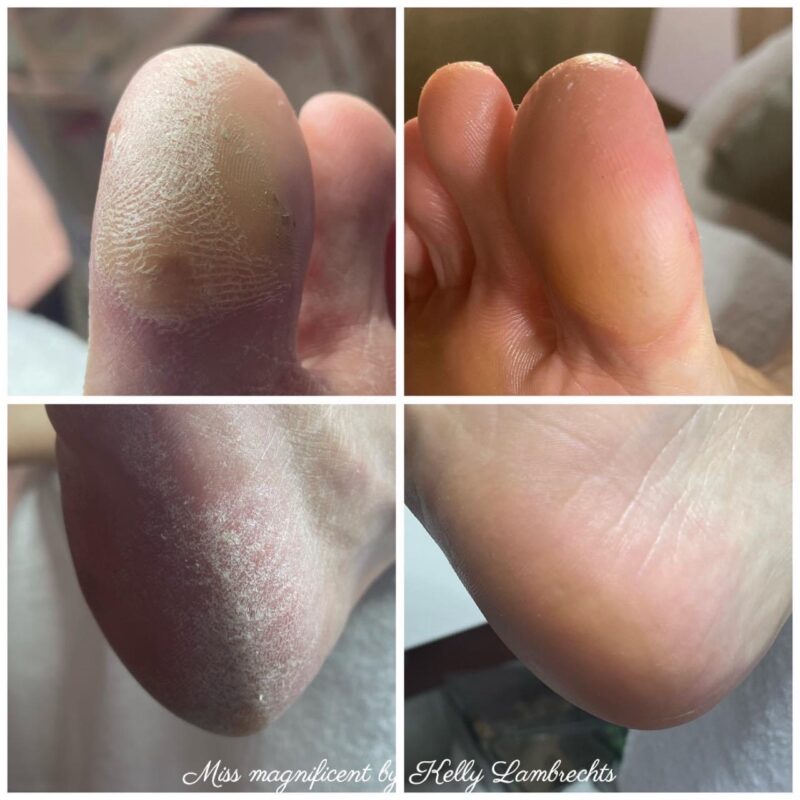 Pedicure